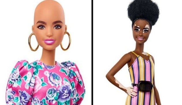 Boneca careca, à direita; boneca com vitiligo, à esquerda