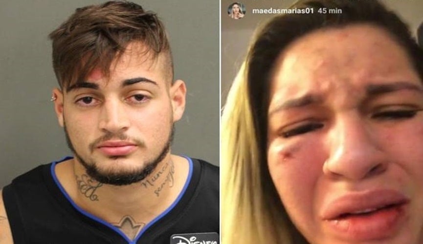 Jogador Jean do time de futebol São Paulo, à direita; esposa do atleta com rosto desfigurado, à esquerda