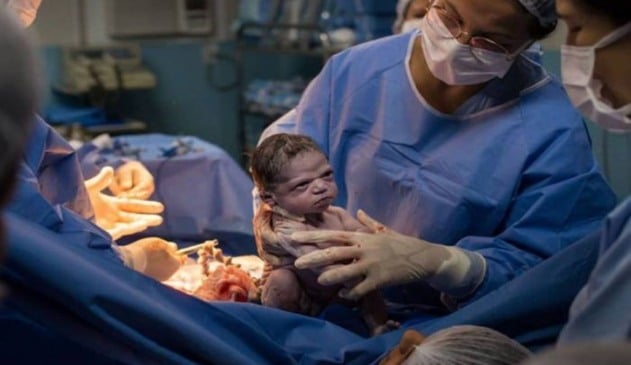 Foto de recém-nascida