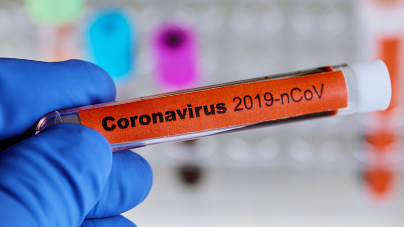 Tubo de sangue rotulado com Covid-19