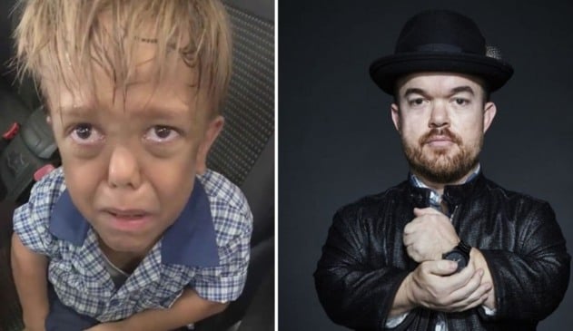 Criança chorando, à esquerda; homem sorrindo, à direita