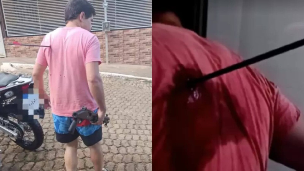 Briga entre vizinhos termina com homem com flecha cravada nas costas
