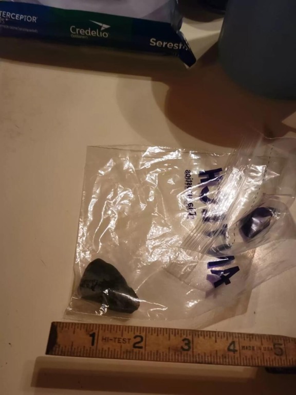 Pedra retirada de estômago de cachorro