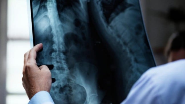 Médico com raio-x na mão