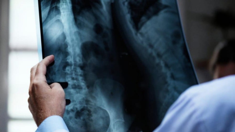 Médico com raio-x na mão
