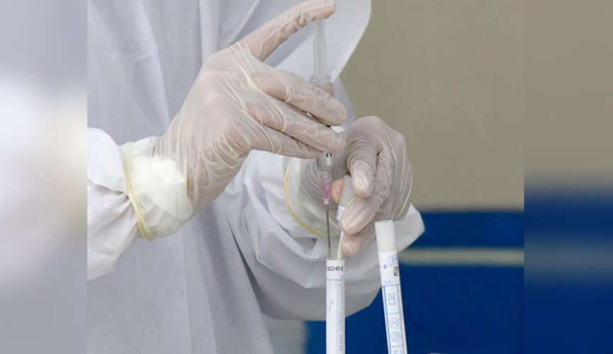 Exame sangue no Instituto Adolfo Lutz. (Foto: Prefeitura de Jundiaí) Exame sangue no Instituto Adolfo Lutz. (Foto: Prefeitura de Jundiaí)