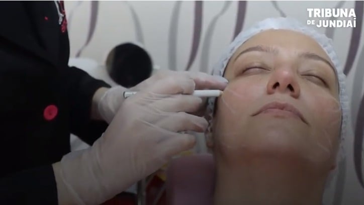 Procedimento estético