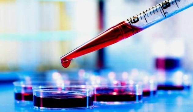 Exame de sangue prevê Alzheimer com 30 anos de antecedência