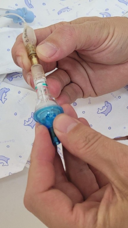 Hospital São Vicente usa dispositivo para evitar pneumonia em pacientes 