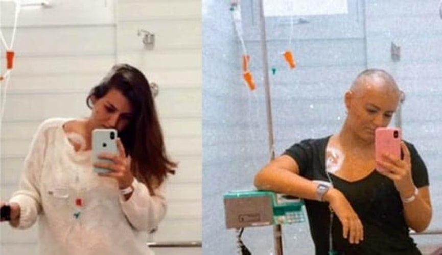 Selfies da mesma jovem com cabelo e sem cabelo