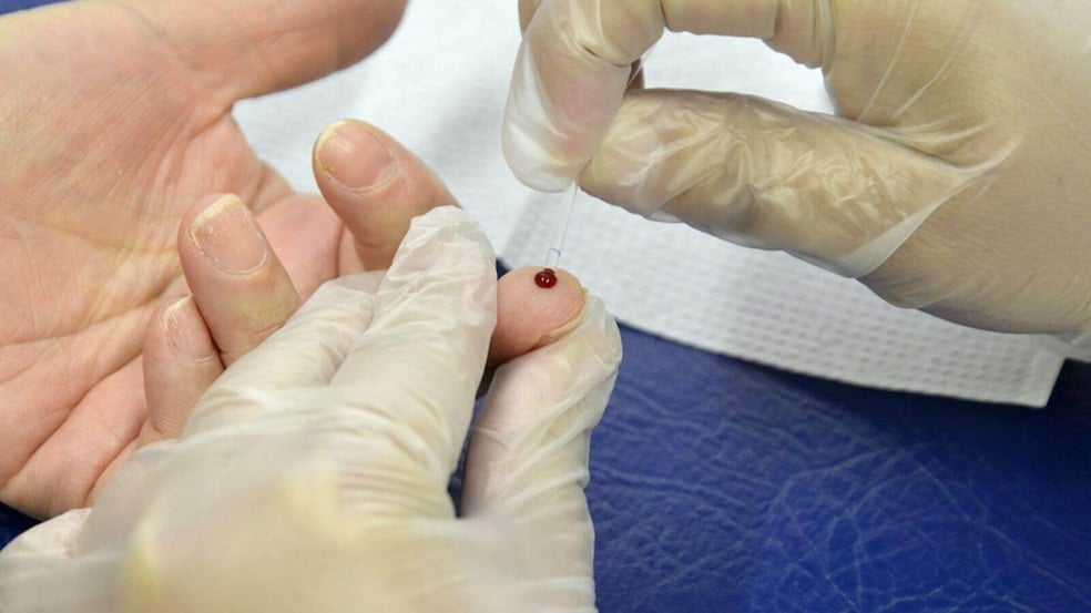 Testagem AIDS Jundiaí