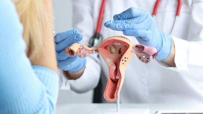 Demonstração de laqueadura