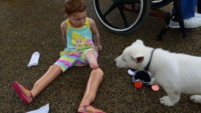 Menina com próteses nas pernas e cachorro branco