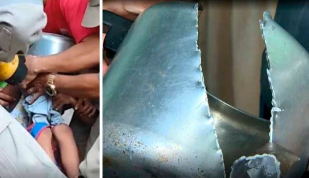 à esquerda, momento em que menino era socorrido por bombeiros, que tentavam tirar a panela de sua cabeça. à direita, foto da panela de pressão cortada