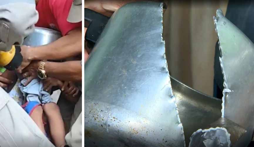 à esquerda, momento em que menino era socorrido por bombeiros, que tentavam tirar a panela de sua cabeça. à direita, foto da panela de pressão cortada