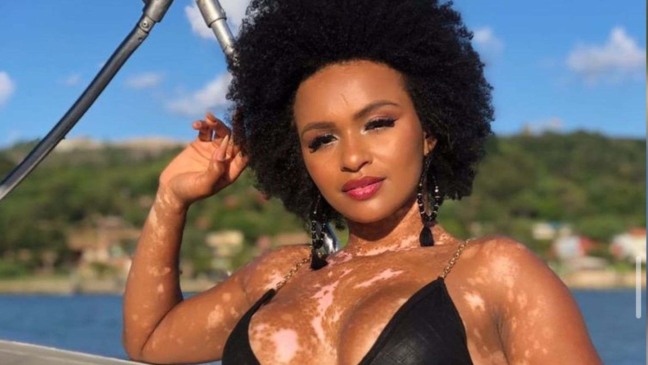 Equipe de Natalia denuncia racismo