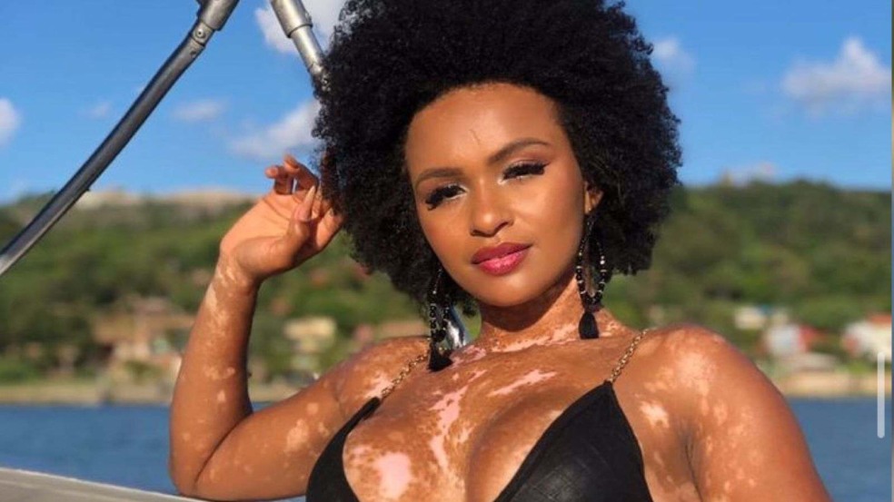 Equipe de Natalia denuncia racismo