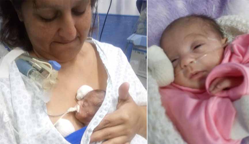 Pequena jundiainse que nasceu com 560 gramas é considerada milagre da medicina 1