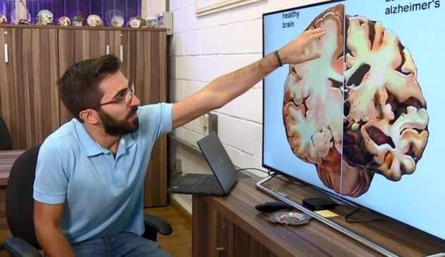 Pesquisadores da Unicamp desenvolvem novo método para diagnosticar Alzheimer, doença degenerativa
