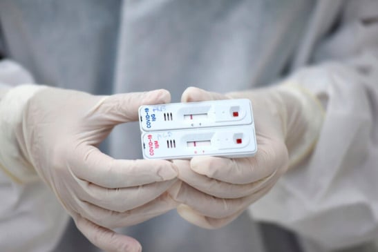 Taxa de transmissão do coronavírus sobe para 1,78 no Brasil