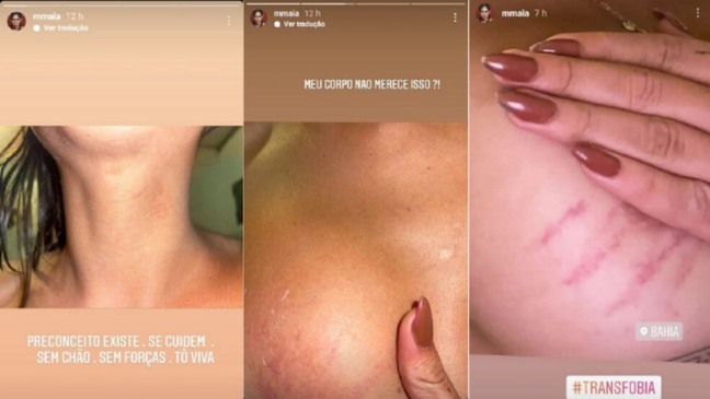 Atriz Global é agredida em Porto Seguro, por transfobia