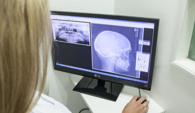 Traumas faciais podem ser resolvidos com a cirurgia buco-maxilo-facial