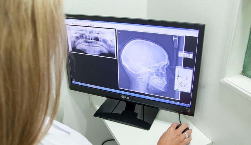 Traumas faciais podem ser resolvidos com a cirurgia buco-maxilo-facial Traumas faciais podem ser resolvidos com a cirurgia buco-maxilo-facial