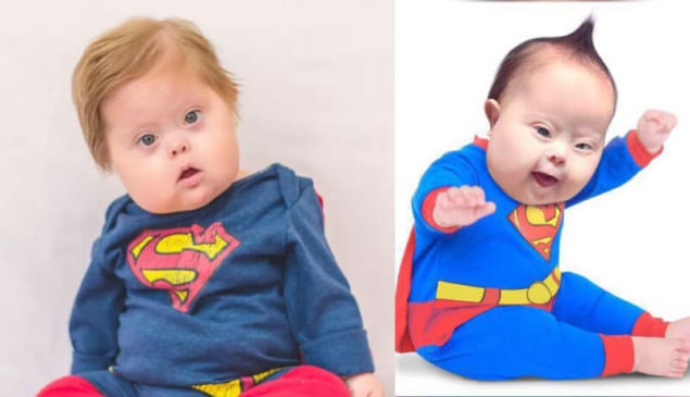 Super Chico, bebê com síndrome de Down que venceu Covid-19, é 'famoso' no Instagram