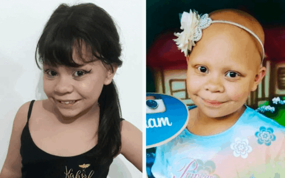 Larissa tem alopecia, doença marcada pela ausência de pelos e cabelos. (Foto: Reprodução/Instagram)