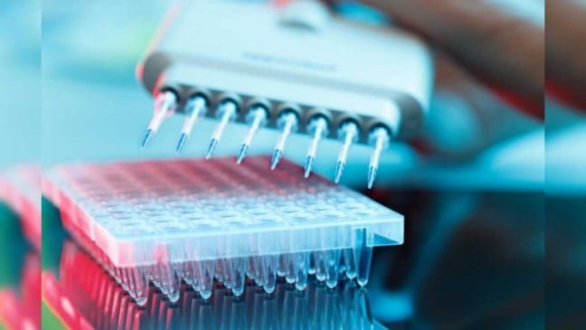 Foto: alzheimersnewstoday