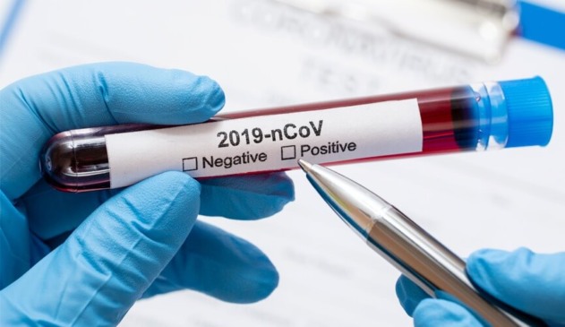 Tubo de ensaio com sangue