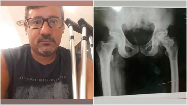 Luciano tem necrose no fêmur e o tratamento custa R$ 30 mil. (Foto: Divulgação)