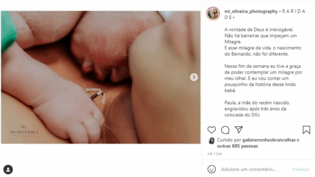 Parto de mãe que usava DIU é registrado por fotógrafa