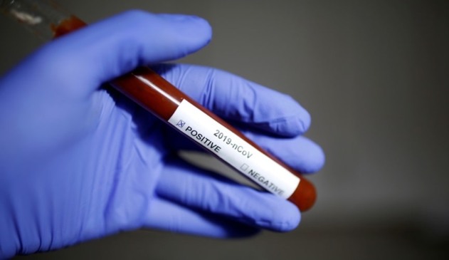 Foto de tubo de ensaio com sangue e etiqueta de identificação de Covid-19