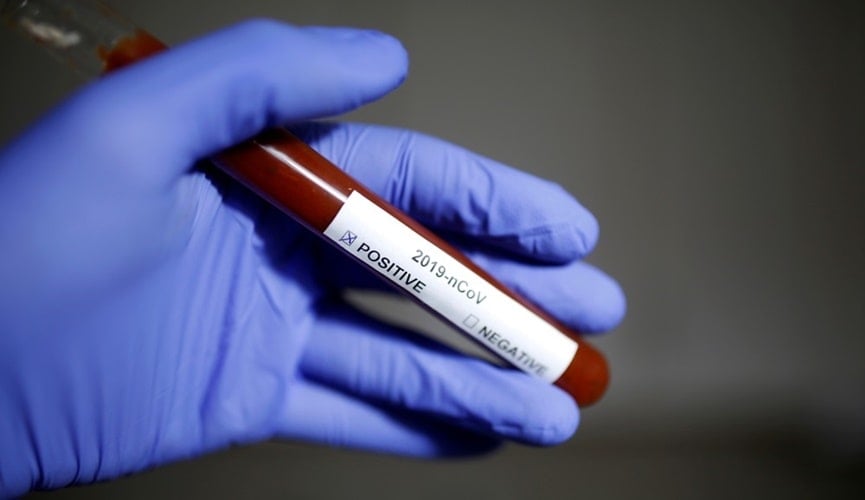 Foto de tubo de ensaio com sangue e etiqueta de identificação de Covid-19 Foto de tubo de ensaio com sangue e etiqueta de identificação de Covid-19