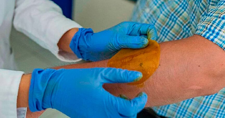 Adesivo de mel para diabéticos. (Foto: Divulgação)