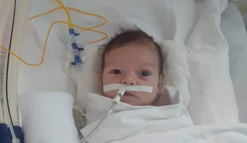 Foto de bebê entubado