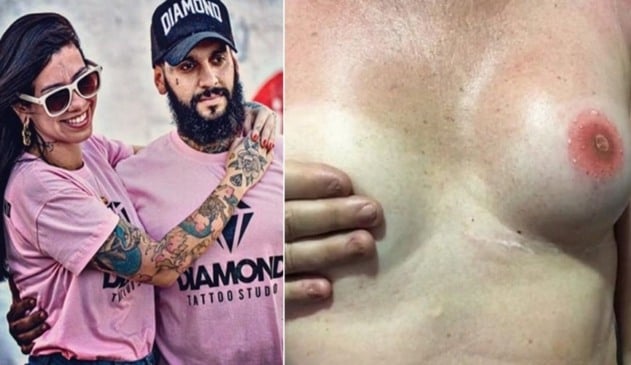 Tatuador reconstrói mamilos e aréolas de pessoas que tiveram câncer de mama