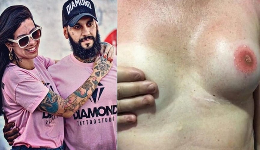 Tatuador reconstrói mamilos e aréolas de pessoas que tiveram câncer de mama