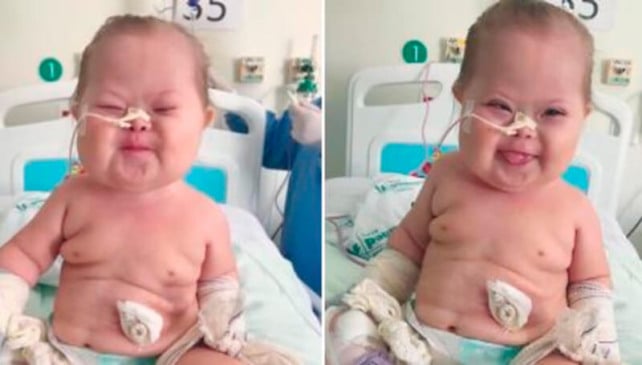 Bebê com síndrome de Down fenômeno na internet comemora vitória contra Covid-19
