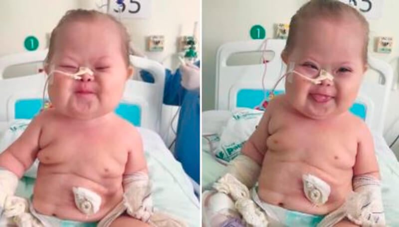Bebê com síndrome de Down fenômeno na internet comemora vitória contra Covid-19