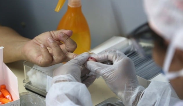 Foto de teste rápido de covid-19