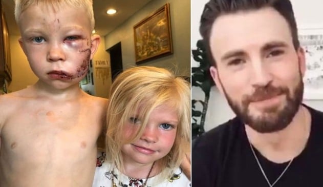 Chris Evans enviará escudo do Capitão América para menino que salvou irmã de ataque de cachorro