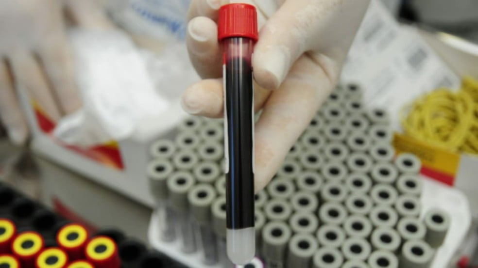 exame-de-sangue_ubs-vila-aparecida-Jundiaí