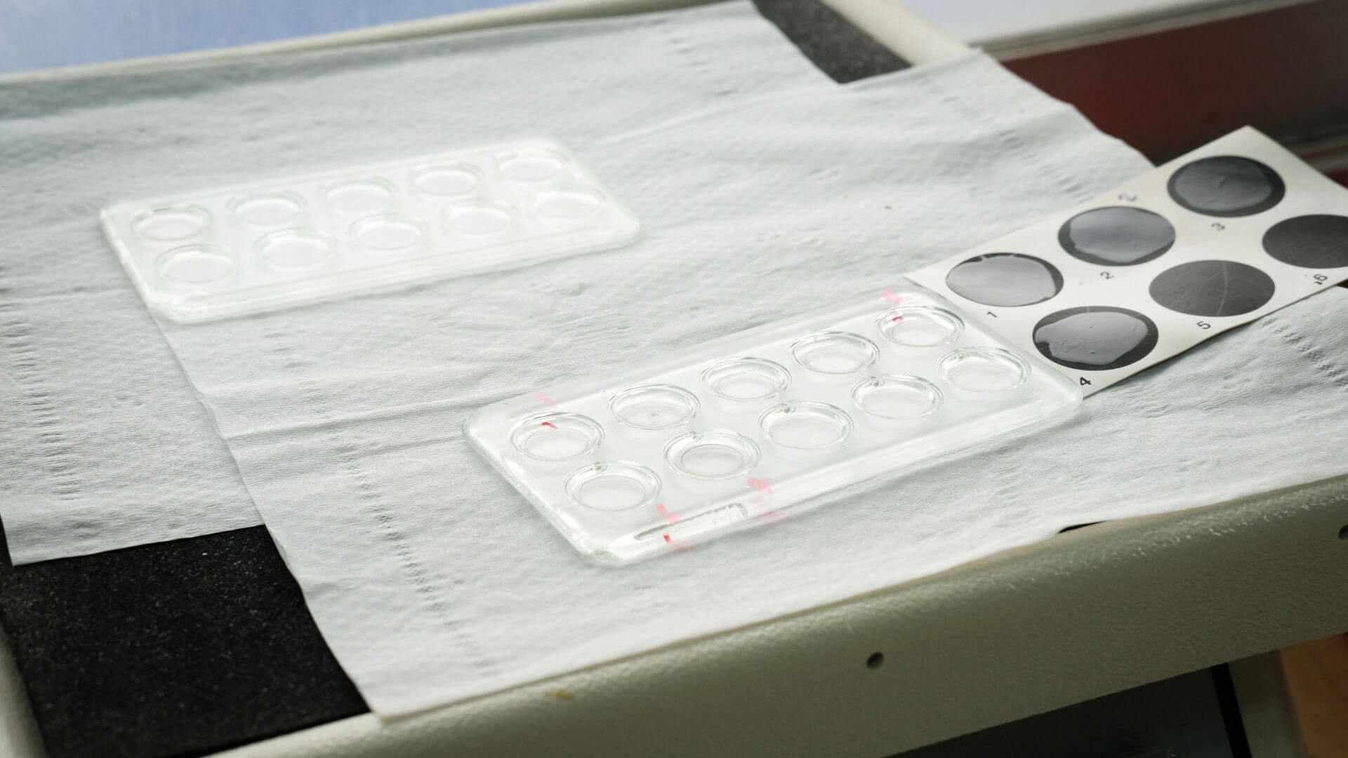 Exame de Sífilis e HIV