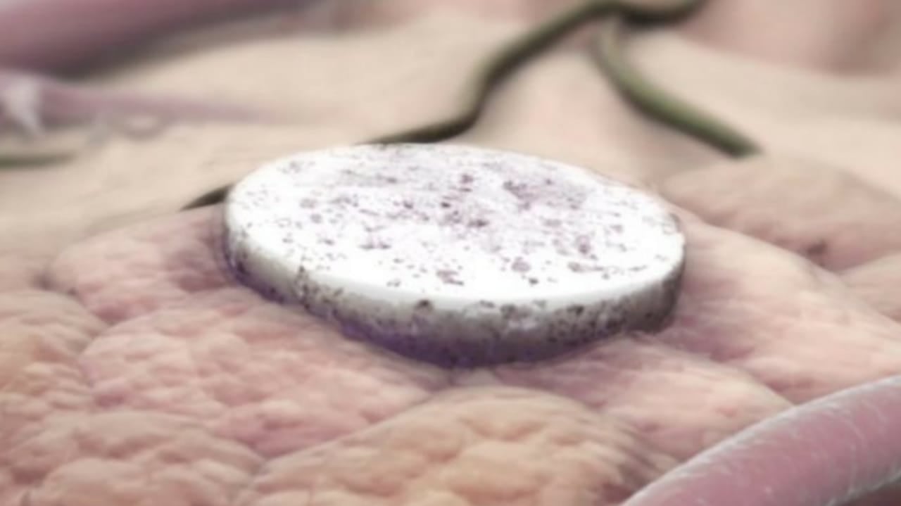 Reprodução da vacina contra câncer desenvolvida pela Harvard