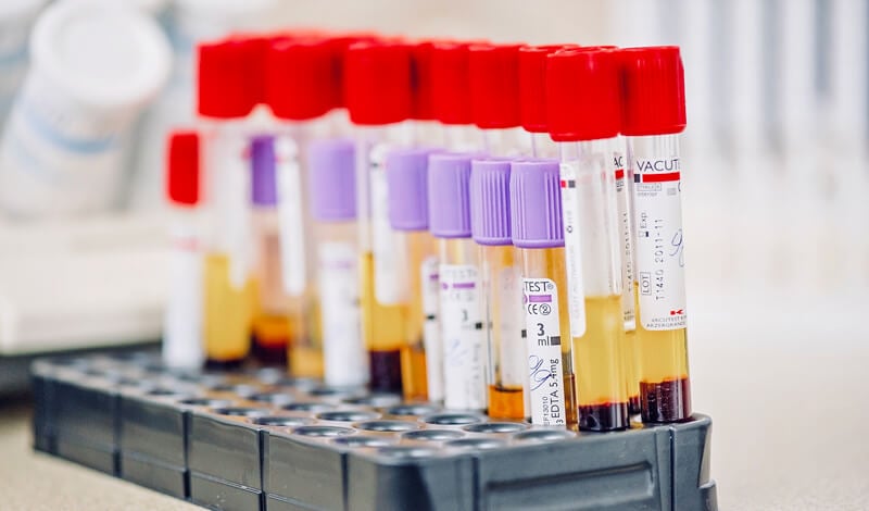 Tubos de laboratório com sangue e soro Tubos de laboratório com sangue e soro