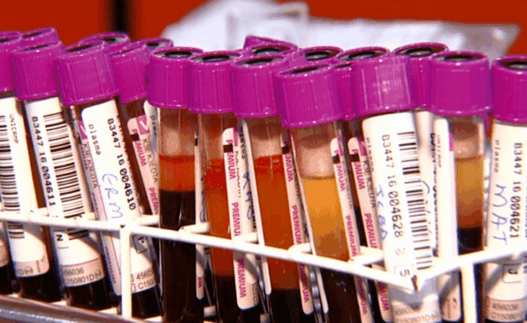 Sangues separados dos plasmas