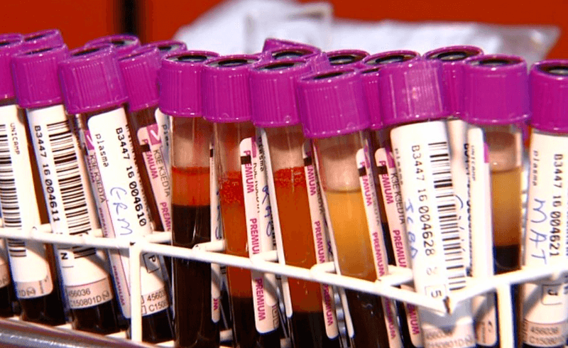 Sangues separados dos plasmas