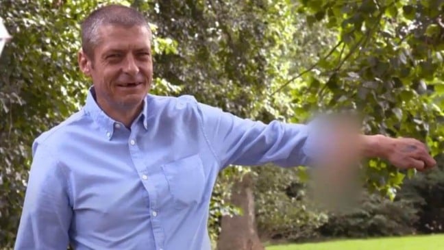 HHomem com pênis no braço. (Foto: Reprodução/The Sun)